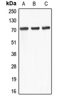 ABCD4 Antibody - Western blot analysis of ABCD4 expression in Jurkat (A); Raji (B); THP1 (C) whole cell lysates.