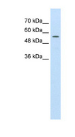 ABCD4 Antibody - ABCD4 antibody ARP43656_T100-EAW81165-ABCD4(ATP-binding cassette, sub-family D (ALD), member 4) Antibody Western blot of HepG2 cell lysate.  This image was taken for the unconjugated form of this product. Other forms have not been tested.