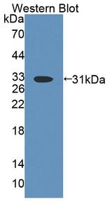 ABCD4 Antibody - Western Blot; Sample: Recombinant protein.