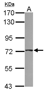 ABCD4 Antibody - Sample (30 ug of whole cell lysate) A: 293T 7.5% SDS PAGE ABCD4 antibody diluted at 1:1000