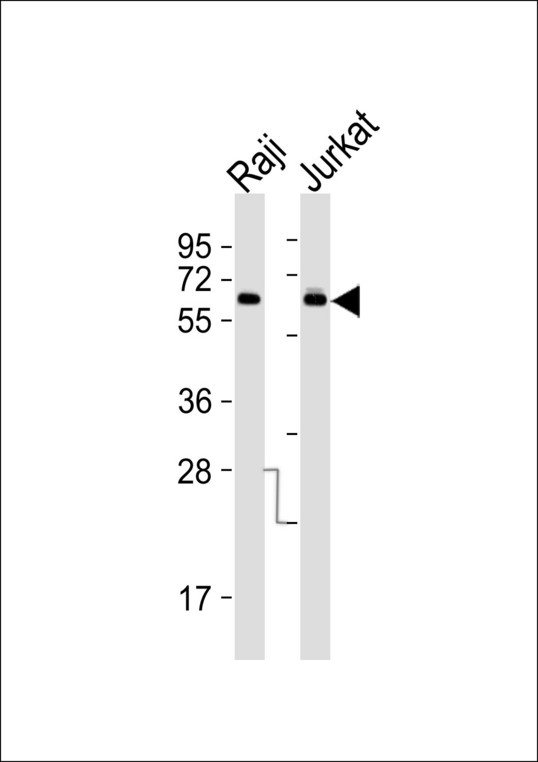 ABCD4 Antibody - All lanes : Anti-ABCD4 Antibody at 1:1000 dilution Lane 1: Raji whole cell lysates Lane 2: Jurkat whole cell lysates Lysates/proteins at 20 ug per lane. Secondary Goat Anti-Rabbit IgG, (H+L),Peroxidase conjugated at 1/10000 dilution Predicted band size : 69 kDa Blocking/Dilution buffer: 5% NFDM/TBST.