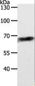 ABCD4 Antibody - Western blot analysis of Jurkat cell, using ABCD4 Polyclonal Antibody at dilution of 1:700.