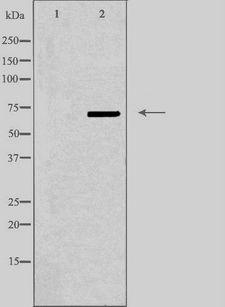 ABCD4 Antibody - Western blot analysis of extracts of HepG2 cells using ABCD4 antibody. The lane on the left is treated with the antigen-specific peptide.