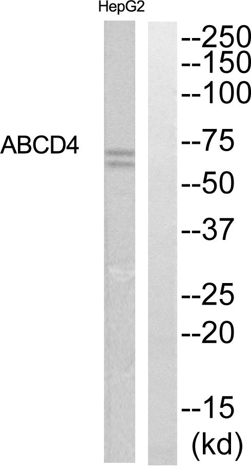 ABCD4 Antibody - Western blot analysis of extracts from HepG2 cells, using ABCD4 antibody.