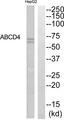 ABCD4 Antibody - Western blot analysis of extracts from HepG2 cells, using ABCD4 antibody.