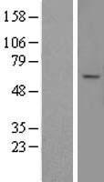 ABCD4 Protein - Western validation with an anti-DDK antibody * L: Control HEK293 lysate R: Over-expression lysate