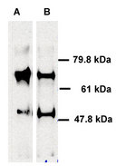 ABCE1 Antibody - Human ABCE1 detected in immunoprecipitated samples using ABCE1 antibody. Lane 1: HeLa cell lysates, Lane 2: HEK 293 cell lysates.  This image was taken for the unconjugated form of this product. Other forms have not been tested.