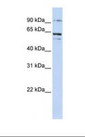 ABCE1 Antibody - Jurkat cell lysate. Antibody concentration: 1.0 ug/ml. Gel concentration: 12%.  This image was taken for the unconjugated form of this product. Other forms have not been tested.