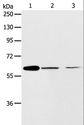 ABCE1 Antibody - Western blot analysis of NIH/3T3 and SKOV3 cell, human ovarian cancer tissue, using ABCE1 Polyclonal Antibody at dilution of 1:450.