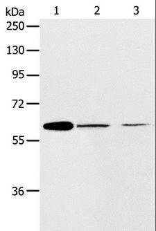 ABCE1 Antibody - Western blot analysis of NIH/3T3 and SKOV3 cell, human ovarian cancer tissue, using ABCE1 Polyclonal Antibody at dilution of 1:450.