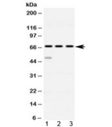 ABCE1 Antibody - Western blot testing of 1) rat spleen, 2) mouse thymus and 3 human HeLa lysate with ABCE1 antibody at 0.5ug/ml. Predicted molecular weight ~67 kDa.