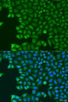 ABCE1 Antibody - Immunofluorescence analysis of U2OS cells using ABCE1 Polyclonal Antibody at dilution of 1:100.Blue: DAPI for nuclear staining.