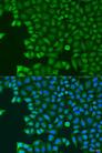ABCE1 Antibody - Immunofluorescence analysis of U2OS cells using ABCE1 Polyclonal Antibody at dilution of 1:100.Blue: DAPI for nuclear staining.