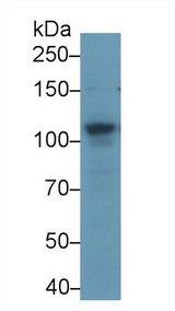 ABCF1 Antibody - Western Blot; Sample: Human k562 cell lysate; ;Primary Ab: 2µg/ml Rabbit Anti-Mouse ABCF1 Antibody;Second Ab: 0.2µg/mL HRP-Linked Caprine Anti-Rabbit IgG Polyclonal Antibody;