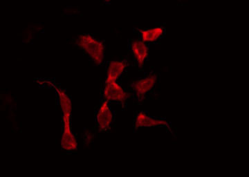 ABCF1 Antibody - Staining HeLa cells by IF/ICC. The samples were fixed with PFA and permeabilized in 0.1% Triton X-100, then blocked in 10% serum for 45 min at 25°C. The primary antibody was diluted at 1:200 and incubated with the sample for 1 hour at 37°C. An Alexa Fluor 594 conjugated goat anti-rabbit IgG (H+L) Ab, diluted at 1/600, was used as the secondary antibody.