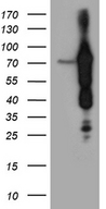 ABCF2 Antibody - HEK293T cells were transfected with the pCMV6-ENTRY control. (Left lane) or pCMV6-ENTRY ABCF2. (Right lane) cDNA for 48 hrs and lysed. Equivalent amounts of cell lysates. (5 ug per lane) were separated by SDS-PAGE and immunoblotted with anti-ABCF2. (1:2000)