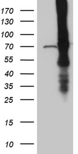 ABCF2 Antibody - HEK293T cells were transfected with the pCMV6-ENTRY control. (Left lane) or pCMV6-ENTRY ABCF2. (Right lane) cDNA for 48 hrs and lysed