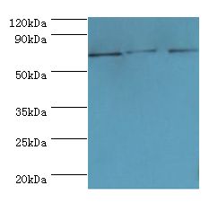 ABCF2 Antibody - Western blot. All lanes: ABCF2 antibody at 4 ug/ml. Lane 1: 293T whole cell lysate. Lane 2: HeLa whole cell lysate. Lane 3: NIH3T3 whole cell lysate. Secondary antibody: Goat polyclonal to rabbit at 1:10000 dilution. Predicted band size: 71 kDa. Observed band size: 71 kDa.