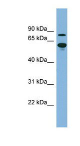 ABCF2 Antibody - ABCF2 antibody Western blot of Fetal Kidney lysate. This image was taken for the unconjugated form of this product. Other forms have not been tested.
