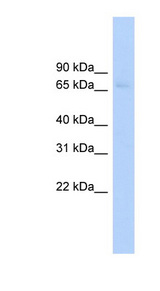 ABCF2 Antibody - ABCF2 antibody Western blot of HepG2 cell lysate. This image was taken for the unconjugated form of this product. Other forms have not been tested.