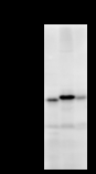 ABCF2 Antibody - Detection of ABCF2 by Western blot. Samples: Whole cell lysate from human HEK293 (H, 25 ug) , mouse NIH3T3 (M, 25 ug) and rat F2408 (R, 25 ug) cells. Predicted molecular weight: 71 kDa