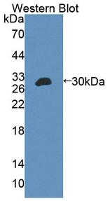 ABCF2 Antibody - Western Blot; Sample: Recombinant protein.