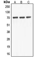 ABCF2 Antibody - Western blot analysis of ABCF2 expression in HEK293T (A); HeLa (B); NIH3T3 (C) whole cell lysates.
