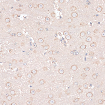 ABCF2 Antibody - Immunohistochemistry of paraffin-embedded mouse brain using ABCF2 antibody at dilution of 1:100 (40x lens).