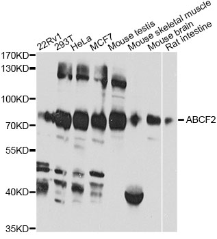 ABCF2 Antibody - Western blot analysis of extracts of various cell lines, using ABCF2 antibody at 1:1000 dilution. The secondary antibody used was an HRP Goat Anti-Rabbit IgG (H+L) at 1:10000 dilution. Lysates were loaded 25ug per lane and 3% nonfat dry milk in TBST was used for blocking. An ECL Kit was used for detection and the exposure time was 60s.