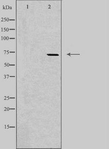 ABCF2 Antibody - Western blot analysis of extracts of HeLa cells using ABCF2 antibody. The lane on the left is treated with the antigen-specific peptide.