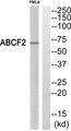 ABCF2 Antibody - Western blot analysis of extracts from HeLa cells, using ABCF2 antibody.