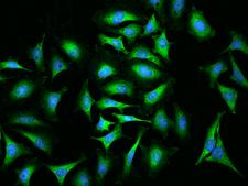ABCF2 Antibody - Immunofluorescence staining of ABCF2 in HeLa cells. Cells were fixed with 4% PFA, permeabilzed with 0.1% Triton X-100 in PBS, blocked with 10% serum, and incubated with rabbit anti-Human ABCF2 polyclonal antibody (dilution ratio 1:1000) at 4°C overnight. Then cells were stained with the Alexa Fluor 488-conjugated Goat Anti-rabbit IgG secondary antibody (green) and counterstained with DAPI (blue). Positive staining was localized to Cytoplasm.