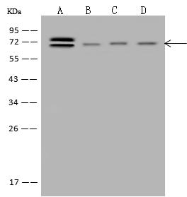 ABCF2 Antibody - Anti-ABCF2 rabbit polyclonal antibody at 1:500 dilution. Lane A: HeLa Whole Cell Lysate. Lane B: 293T Whole Cell Lysate. Lane C: HepG2 Whole Cell Lysate. Lane D: K562 Whole Cell Lysate. Lysates/proteins at 30 ug per lane. Secondary: Goat Anti-Rabbit IgG (H+L)/HRP at 1/10000 dilution. Developed using the ECL technique. Performed under reducing conditions. Predicted band size: 71 kDa. Observed band size: 71 kDa.