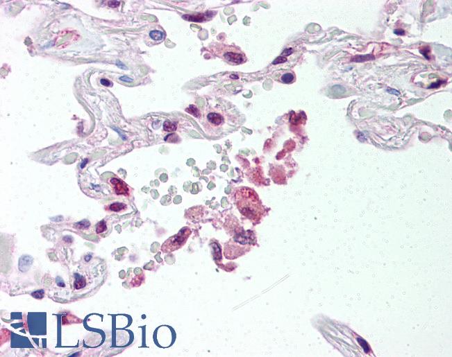 ABCG1 Antibody - Anti-ABCG1 antibody IHC of human lung. Immunohistochemistry of formalin-fixed, paraffin-embedded tissue after heat-induced antigen retrieval. Antibody concentration 20 ug/ml.  This image was taken for the unconjugated form of this product. Other forms have not been tested.