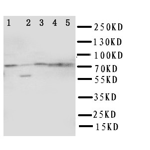 ABCG1 Antibody - WB of ABCG1 antibody. Lane 1: U87 Cell Lysate. Lane 2: SMMC Cell Lysate. Lane 3: HELA Cell Lysate. Lane 4: COLO320 Cell Lysate. Lane 5: MCF-7 Cell Lysate.