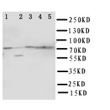 ABCG1 Antibody - WB of ABCG1 antibody. Lane 1: U87 Cell Lysate. Lane 2: SMMC Cell Lysate. Lane 3: HELA Cell Lysate. Lane 4: COLO320 Cell Lysate. Lane 5: MCF-7 Cell Lysate.