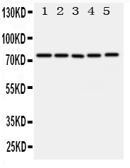 ABCG1 Antibody - Anti-ABCG1 antibody, Western blotting All lanes: Anti ABCG1 at 0.5ug/ml Lane 1: U87 Whole Cell Lysate at 40ug Lane 2: SMMC Whole Cell Lysate at 40ug Lane 3: HELA Whole Cell Lysate at 40ug Lane 4: COLO320 Whole Cell Lysate at 40ug Lane 5: MCF-7 Whole Cell Lysate at 40ug Predicted bind size: 75KD Observed bind size: 75KD