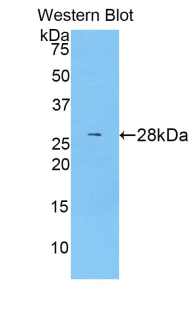 ABCG1 Antibody - Western blot of recombinant ABCG1.  This image was taken for the unconjugated form of this product. Other forms have not been tested.