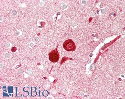 ABCG1 Antibody - Human Brain, Cortex: Formalin-Fixed, Paraffin-Embedded (FFPE)