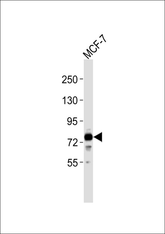ABCG1 Antibody - Anti-ABCG1 Antibody at 1:1000 dilution + MCF-7 whole cell lysates Lysates/proteins at 20 ug per lane. Secondary Goat Anti-Rabbit IgG, (H+L),Peroxidase conjugated at 1/10000 dilution Predicted band size : 76 kDa Blocking/Dilution buffer: 5% NFDM/TBST.