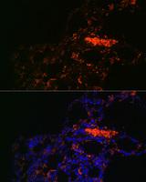 ABCG1 Antibody - Immunofluorescence analysis of Rat lung using ABCG1 Polyclonal Antibody at dilution of 1:100.Blue: DAPI for nuclear staining.