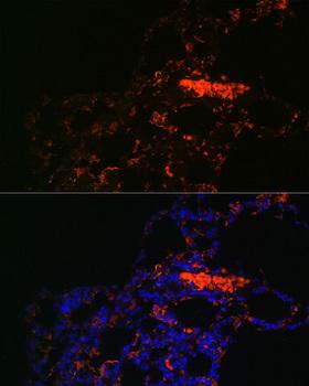 ABCG1 Antibody - Immunofluorescence analysis of Rat lung using ABCG1 Polyclonal Antibody at dilution of 1:100.Blue: DAPI for nuclear staining.