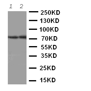 ABCG4 Antibody - Anti-ABCG4 antibody, Western blotting Lane 1: Rat Brain Tissue LysateLane 2: Mouse Brain Tissue Lysate