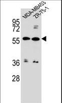ABCG4 Antibody - ABCG4 Antibody western blot of MDA-MB453,ZR-75-1 cell line lysates (35 ug/lane). The ABCG4 antibody detected the ABCG4 protein (arrow).