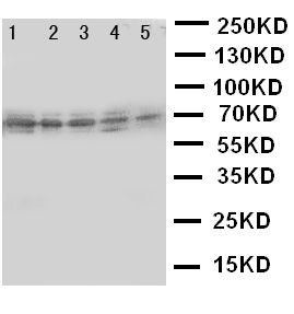 ABCG5 Antibody - WB of ABCG5 antibody. Lane 1: MCF-7 Cell Lysate. Lane 2: A549 Cell Lysate. Lane 3: HT1080 Cell Lysate. Lane 4: U87 Cell Lysate. Lane 5: SKOV Cell Lysate..