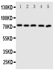 ABCG5 Antibody - Western blot analysis of ABCG5 using anti-ABCG5 antibody. Electrophoresis was performed on a 5-20% SDS-PAGE gel at 70V (Stacking gel) / 90V (Resolving gel) for 2-3 hours. The sample well of each lane was loaded with 50ug of sample under reducing conditions. Lane 1: MCF-7 Whole Cell Lysate Lane 2: A549 Whole Cell Lysate Lane 3: HT1080 Whole Cell Lysate Lane 4: U87 Whole Cell Lysate Lane 5: SKOV Whole Cell Lysate After Electrophoresis, proteins were transferred to a Nitrocellulose membrane at 150mA for 50-90 minutes. Blocked the membrane with 5% Non-fat Milk/ TBS for 1.5 hour at RT. The membrane was incubated with rabbit anti-ABCG5 antigen affinity purified polyclonal antibody at 0.5 µg/mL overnight at 4°C, then washed with TBS-0.1% Tween 3 times with 5 minutes each and probed with a goat anti-rabbit IgG-HRP secondary antibody at a dilution of 1:10000 for 1.5 hour at RT. The signal is developed using an Enhanced Chemiluminescent detection (ECL) kit with Tanon 5200 system. A specific band was detected for ABCG5 at approximately 73KD. The expected band size for ABCG5 is at 73KD.