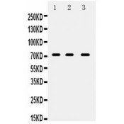 ABCG5 Antibody - ABCG5 antibody Western blot. All lanes: Anti ABCG5 at 0.5 ug/ml. Lane 1: MCF-7 Whole Cell Lysate at 40 ug. Lane 2: A549 Whole Cell Lysate at 40 ug. Lane 3: PANC Whole Cell Lysate at 40 ug. Predicted band size: 73 kD. Observed band size: 73 kD.