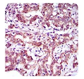 ABCG5 Antibody - Immunohistochemistry: ABCG5 Antibody (1B5E10) - IHC analysis of paraffin-embedded human cervical tissues with DAB staining.  This image was taken for the unconjugated form of this product. Other forms have not been tested.