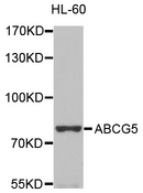 ABCG5 Antibody - Western blot analysis of extracts of HL-60  cells.