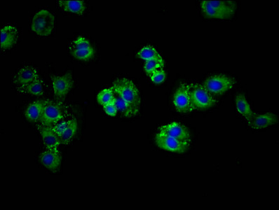 ABCG5 Antibody - Immunofluorescence staining of HepG2 cells at a dilution of 1:166, counter-stained with DAPI. The cells were fixed in 4% formaldehyde, permeabilized using 0.2% Triton X-100 and blocked in 10% normal Goat Serum. The cells were then incubated with the antibody overnight at 4°C.The secondary antibody was Alexa Fluor 488-congugated AffiniPure Goat Anti-Rabbit IgG (H+L) .